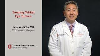 Treating orbital eye tumors | Ohio State Medical Center