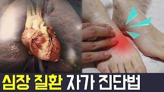 [Balance Of Life] 발만 만져봐도 심장 질환을 알 수 있다? * 3가지 전조 증상* l 닥터 지바고