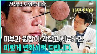 성인 여드름 치료! 이게 가능 하다고? 미라클 ~ 미라젯