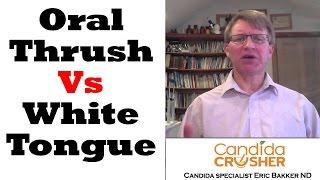 What Is The Difference Between A White Tongue And Oral Thrush?  Ask Eric Bakker