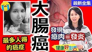 健康好生活  20220926    最多人得的癌症！病從口入「大腸癌」