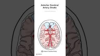 Everything you need to know about Stroke Localisation! #neurology #health #medicalschool #medstudent