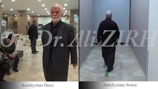 Alaattin TERLİKLİ / Parkinson Beyin Pili Ameliyatı Öncesi ve 3 Hafta Sonrası