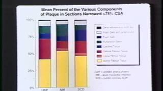 Dolan Lecture Series 1990 - William C. Roberts, MD