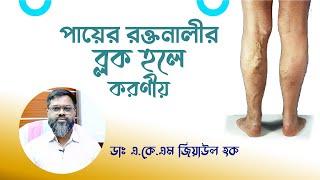 পায়ের রক্তনালী ব্লক হলে করনীয় | Varicose Veins Bangla Tips | Dr. AKM Ziaul Huque | Doctor Tube