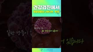 건강검진에서 췌장낭종 물혹이 나왔다면??  #췌장낭종 #췌장물혹 #췌장암