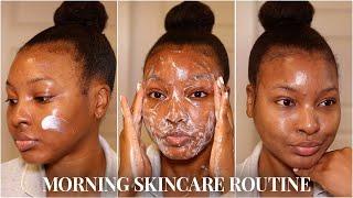 MORNING SKINCARE ROUTINE FOR ACNE PRONE/ TEXTURED SKIN | DARK SPOTS & HYPERPIGMENTATION | KENSTHETIC