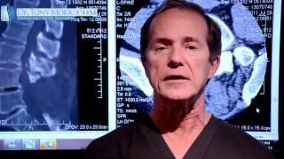 Epidural Steroid For Lumbar Spinal Stenosis Pros and Cons by Dr. Tony Mork