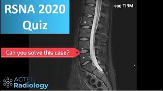 Win FREE Wrist MRI Masterclass - RSNA2020 Quiz