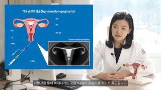 [난임검사] 자궁난관조영술 (서울의료원 가임센터) #난임치료 #난임센터 #시험관아기 #인공수정 #난임시술 #난임