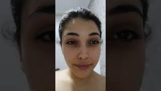برای اولین بار رفتم لیزر