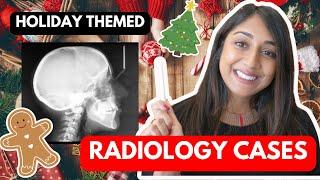 Radiology Cases: Holiday Edition 