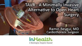 TAVR - A Minimally Invasive Alternative to Open Heart Surgery