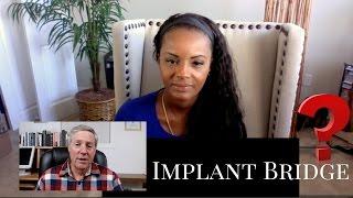 Dental Implant bridge Top questions: No more partial dentures