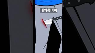 칼에 허벅지 찔렸을때 살아남는 방법(틀리면 다 끝입니다..)