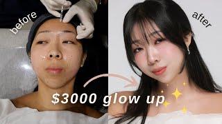 korea glow up & what i crocheted (skin clinic, idol makeup, nails, profile pic, haircut, yarn cafe)