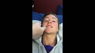 Treatment of TMJ Disorder in 5 mins demonstrates by Dr. Lombardi DC www.dranthonylombardi.com