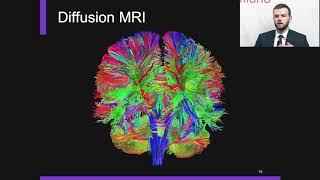 Erind Alushaj Parkinson Fall Conference Speaker 3
