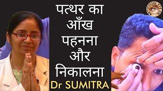 Artificial eye wearing and removal explained in Hindi | Step by step | Dr Sumitra