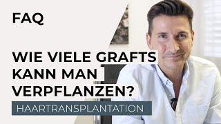 Haartransplantation - Wie viele Grafts kann man transplantieren?