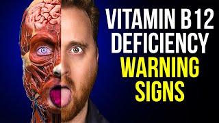 10 Vitamin B12 Deficiency Symptoms To Never Ignore