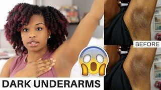 How To Lighten Dark Underarms Naturally and Fast | BEFORE AND AFTER RESULTS! | journeytowaistlength