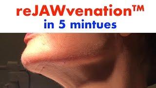 reJAWvenator in action on a reJAWvenation™ ft. Dr Steven Weiner