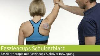 Faszientherapie Schulterblatt mit PINO Faszien Cups | PINO Massage