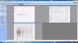 Total Protein Normalization - Advanced Tutorial