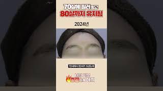 필러 맞고 10년이 지나면??