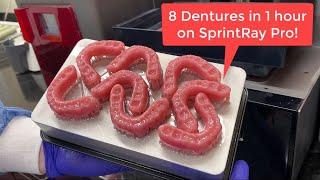 3D Printing Dentures with Nextdent 3D+ and SprintRay Pro 3D Printer!