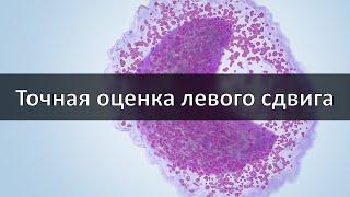 Точная оценка левого сдвига в современном анализе крови. Палочки или новые технологии?