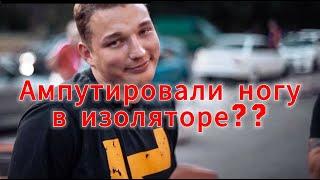 Эдварду Билу ампутировали ногу!?