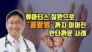 류마티스 질병들과 콩팥병: 망가지는것을 미리 방지해야