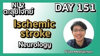 ตะลุยโจทย์ NL2 คละโจทย์ DAY 151 “Ischemic stroke” | MedSalmon ติว NL by พี่ซี