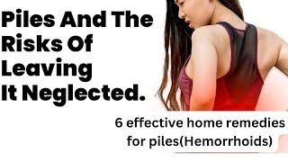 "Natural Home Remedies for Piles (Hemorrhoids) Relief | Get Rid of Piles Fast!"