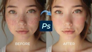 Photoshop: How to Smooth Skin and Remove Blemishes Quickly