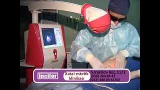 Xezer tv inciler verliwi236