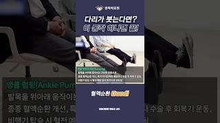 다리가 붓는다면? 이 동작 하나면 끝! [정형외과 정비오 교수]