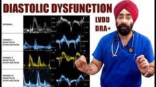 Rx Heart #19 (Eng) Diastolic Dysfunction | LVDD | Diastolic Heart Failure | DRA (ENG) Dr.Education