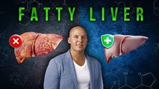 BIGGEST Contributing Factor of LIVER DISEASE (It's not Alcohol) | Dr. Patrick Flynn