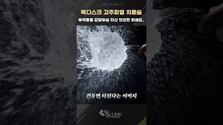 목디스크, 급하다고 고주파열치료 받으면 #목디스크 #디스크수술