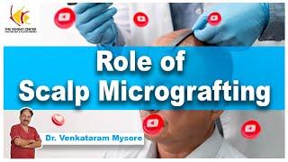 The Role of Scalp Micrografting | Dr. Venkataram Mysore | The Venkat Center, Bengaluru