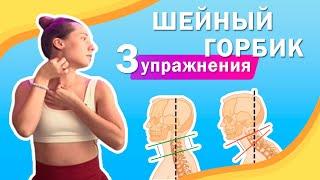 Шейный горбик. 3 упражнения. Нарушение осанки, шейный лордоз, холка. Головные боли, боли в шее