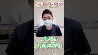 [O,X버전] 얼굴지방이식 후 시간이 지나면 지방이 흐를까?