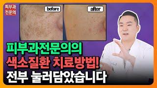 색소질환에 대한 궁금증 및 내게 맞는 레이저 알려드립니다! ｜실제 시술영상｜치료방법