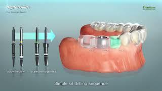 Dentium Digital Guide