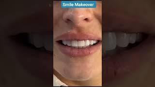Dental Health Care | Dr. Wasif Rashid | Dentist | #foryou #shorts