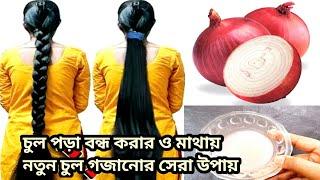 অতিরিক্ত চুল পড়া বন্ধ করার ও মাথায় নতুন চুল গজানোর ১০০% কার্যকরী উপায় / Hairfall solution