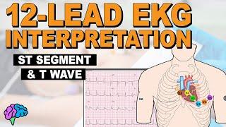 The ST Segment and T Wave REVIEW